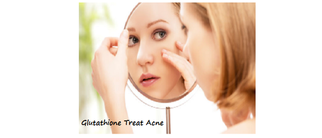 Glutathione Treat Acne.png