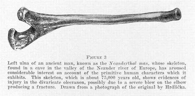 Left_ulna_of_the_Neanderthal_Man_Wellcome_M0003714.jpg