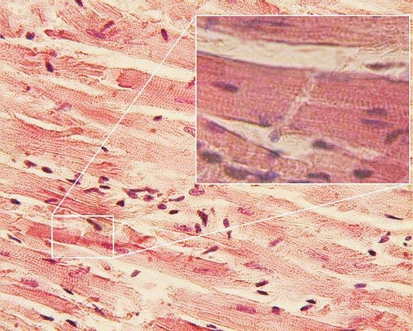 Myocardium.jpg