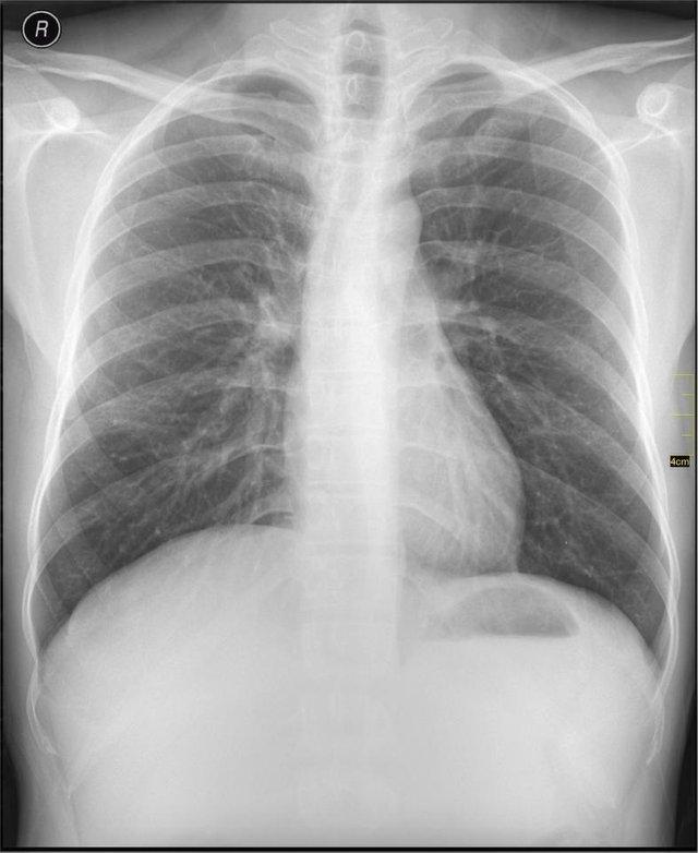 Medical_X-Ray_imaging_ABW02_nevit.jpeg