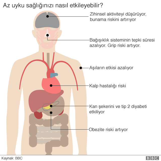 _98537070_sleep_in_charts_body_v2_640_turkish-nc.png