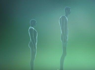 sindrome-marfan.jpg