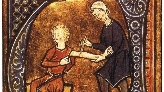list-ancient-medical-techniques-bloodletting-E.jpeg