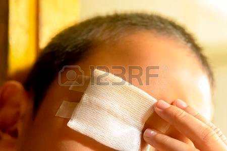 75527612-wound-care-or-wound-on-eye-of-child-close-up-and-concept-for-health.jpg