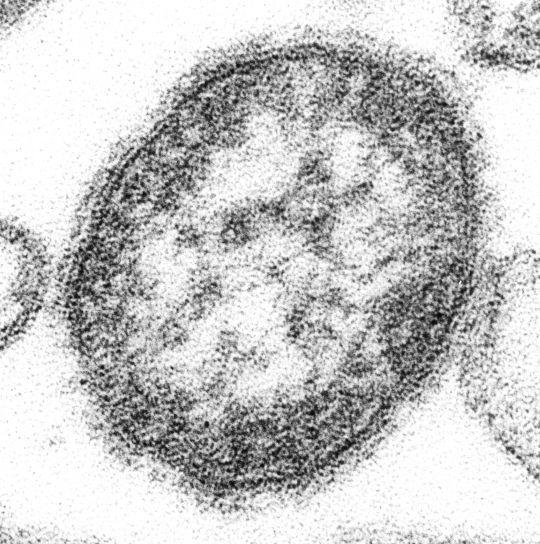 he-measles-virus-is-a-paramyxovirus-of-the-genus-morbillivirus-540x544.jpg