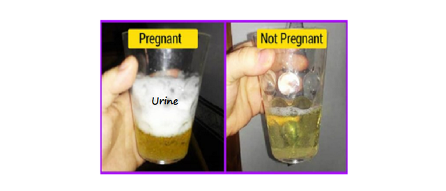 Urine.png