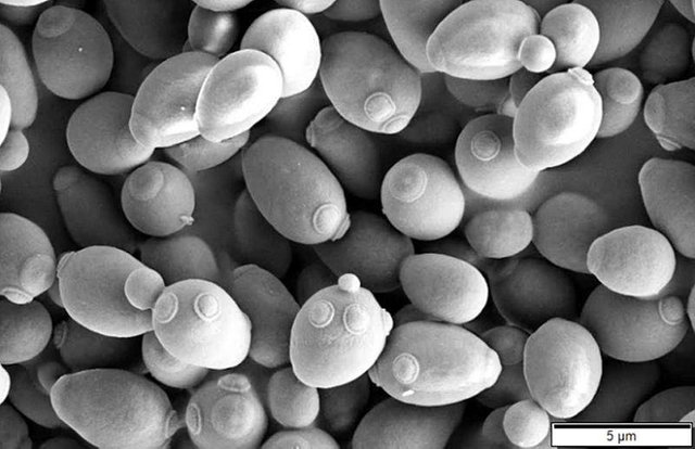 800px-Saccharomyces_cerevisiae_SEM.jpg