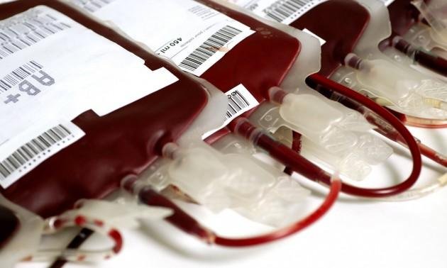 transfusión-de-sangre-630x378.jpg