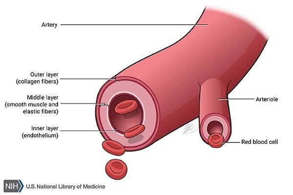 Marfan syndrome