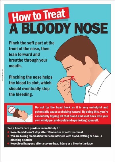 PICKING your NOSE causes NOSEBLEEDING — Steemit