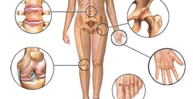 Image result for arthritis control from papaya image