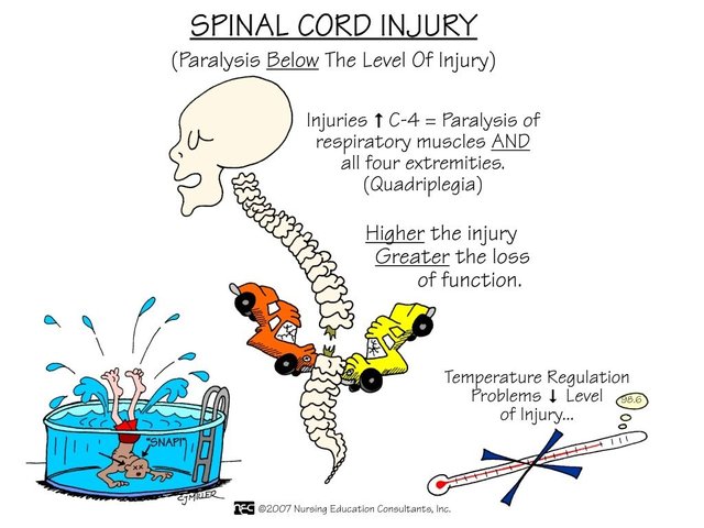 Spinal cord injury complications