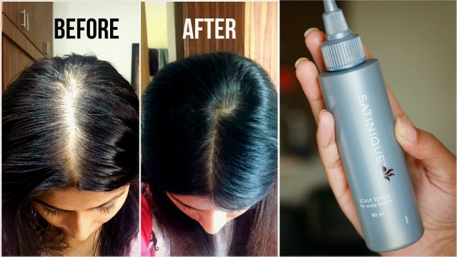 How to increase hair density — Steemit