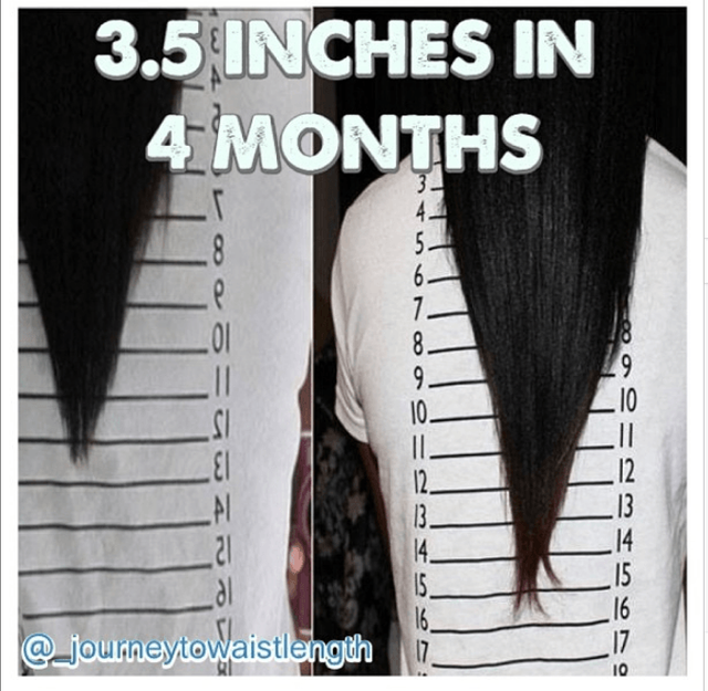 Inversion Method for Hair Growth Is It Effective