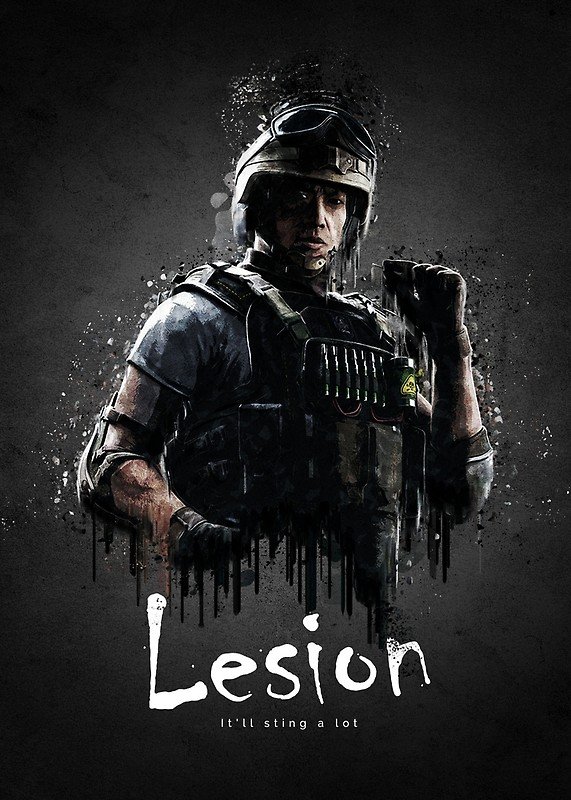 Lesion – Rainbow Six Siege [Review] — Steemit