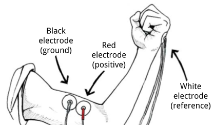 01_11_18_biomech_muscle_electrodes_1