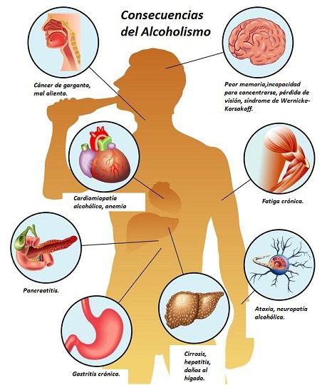 consecuencias_del_alcoholismo_en_la_salud