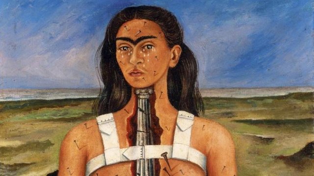 frida-kahlo-tenia-fibromialgia-y-no-lo-sabia_ampliacion.jpg