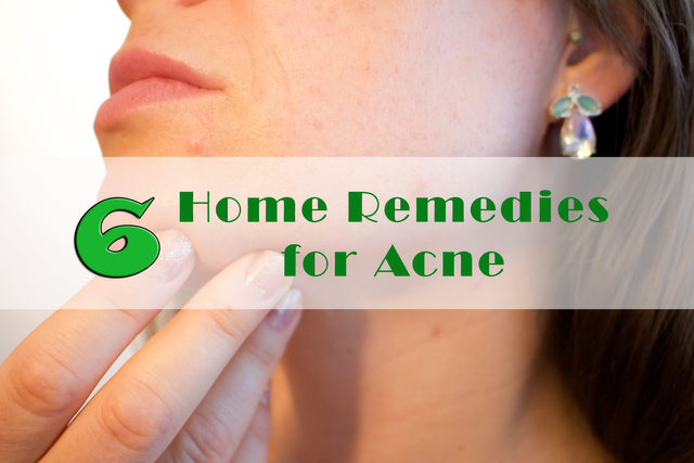 acne-1606765_1920.png