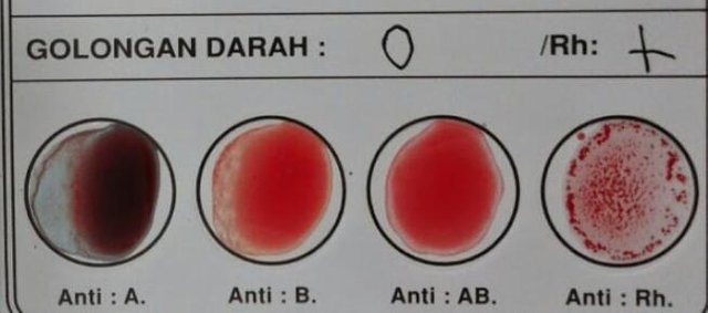 34+ Blood Type O And A Relationship Background