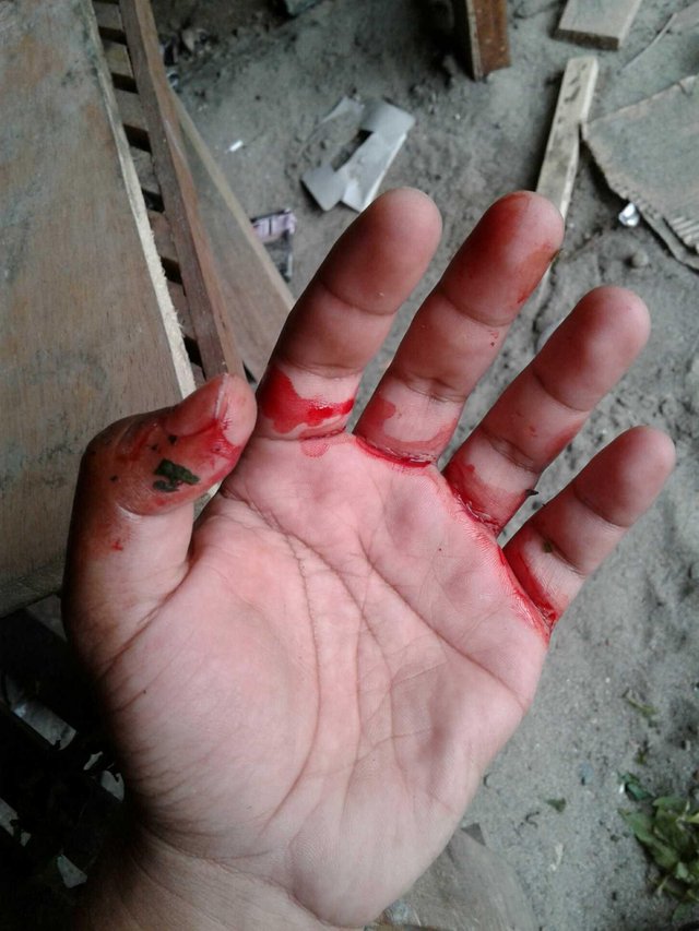 Gambar Tangan Berdarah