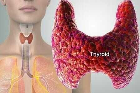 Sfhealth || Hyperthyroid - Symptoms, Causes, and Treatment — Steemit