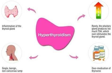 Sfhealth || Hyperthyroid - Symptoms, Causes, and Treatment — Steemit