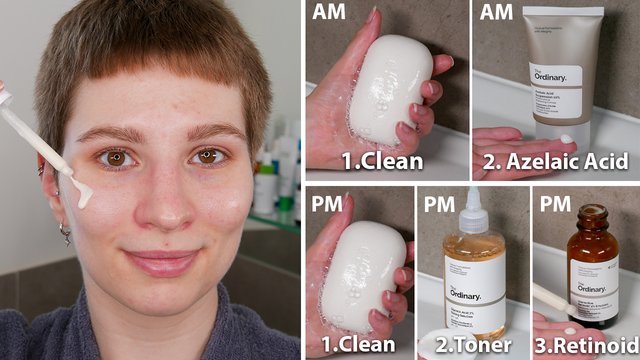 The ordinary acne store scar treatment