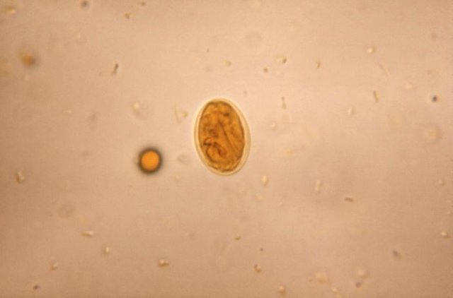 microfotografÃ­a, giardia lamblia, quiste, yodo, tÃ©cnica