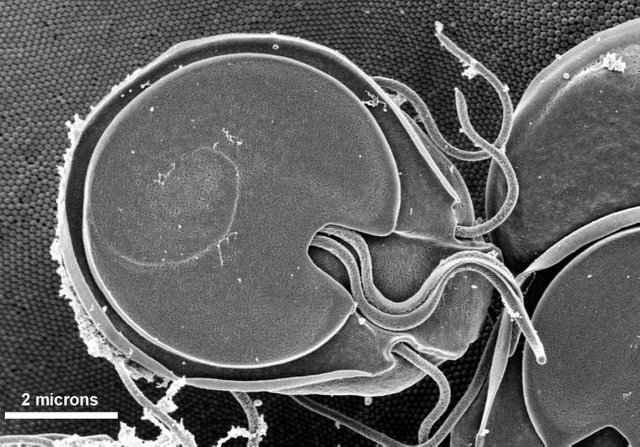 giardia