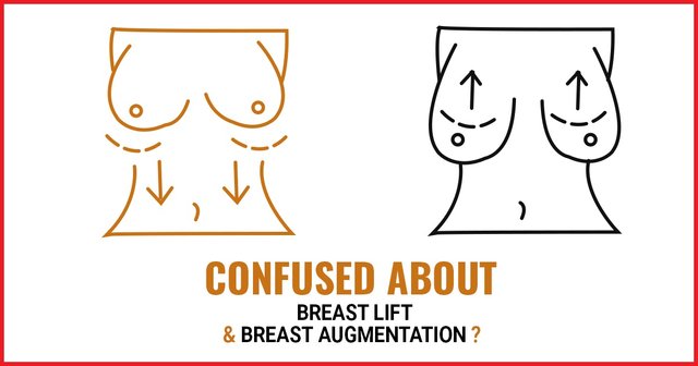 Dr. Trussler Breast Augmentation Austin Tx