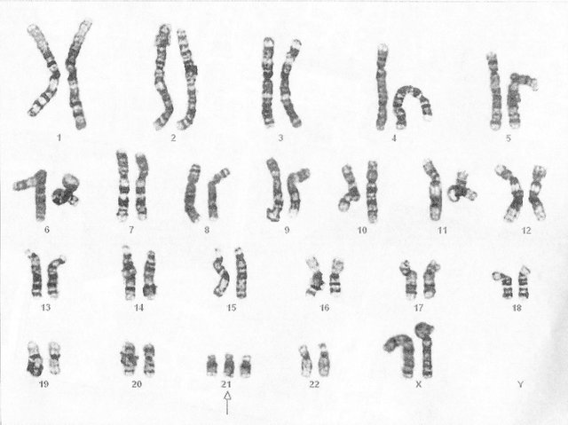 karyotype_2cropped.jpg