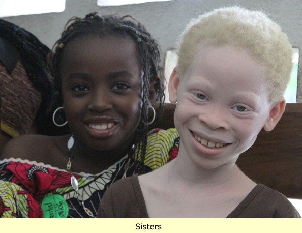 Albino_sister.jpg