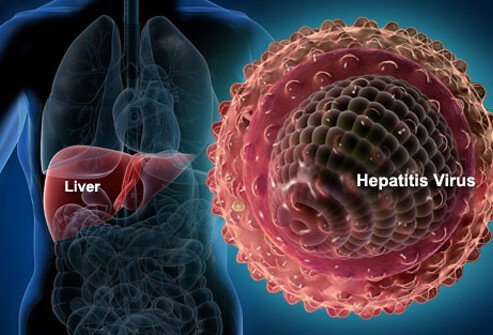 hepatitis-s1-liver-hepatitis-virus.jpg