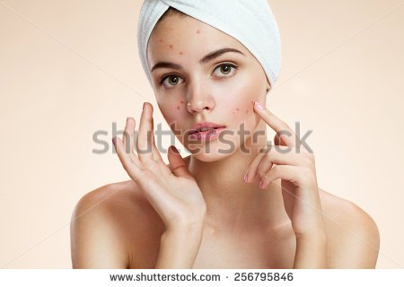 acne.jpg