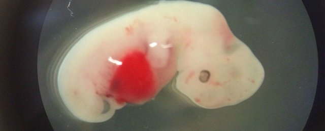 288-sheep-human-hybrid-chimera-pig-embryo_1024.jpg