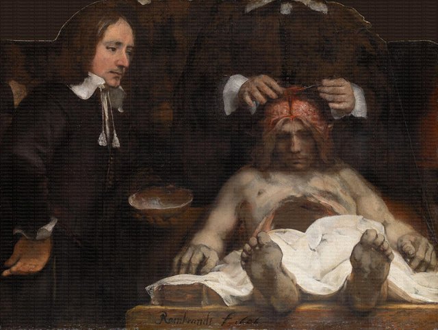 Rembrandt Harmenszoon van Rijn - The anatomy lesson of Dr. Joan Deyman.jpg