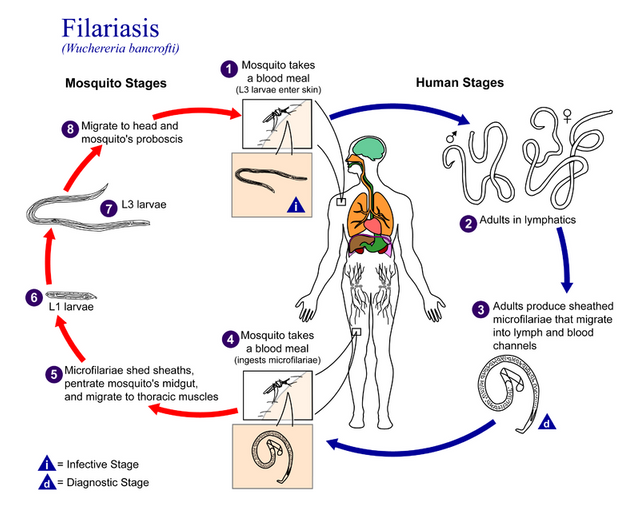 800px-Filariasis_01.png