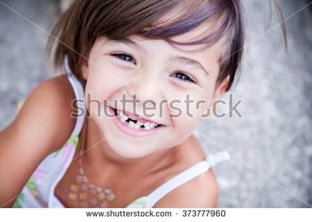 stock-photo-little-girl-with-big-smile-and-missing-milk-teeth-373777960.jpg