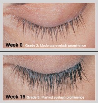 Image result for Idol Lash Review - Ultimate Eyelash Enhancer Serum steem it
