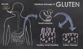 bigstock-intestinal-damage-of-gluten-56636603