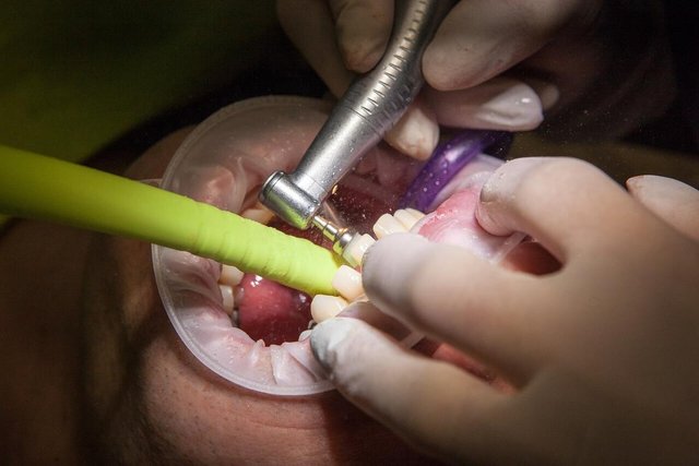 Dental Repairs