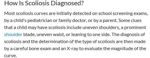 scolioses How is Scoliosis Diagnosed