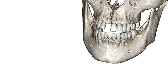 Invivo-Anatomage-Volume-3D-bone2-LONG3-jpg.jpg