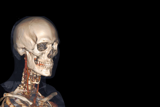 Head-Anatomage-Volume-Rendering-15-Better-jpg-resized-for-slider-EDITED5.png