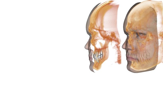 Anatomage-3D-Analysis-Invivo-3D-Photograph-2-LONG-jpg5.jpg