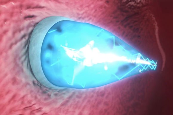 New-Technique-Repairs-Holes-in-the-Heart-Without-Surgery.jpg