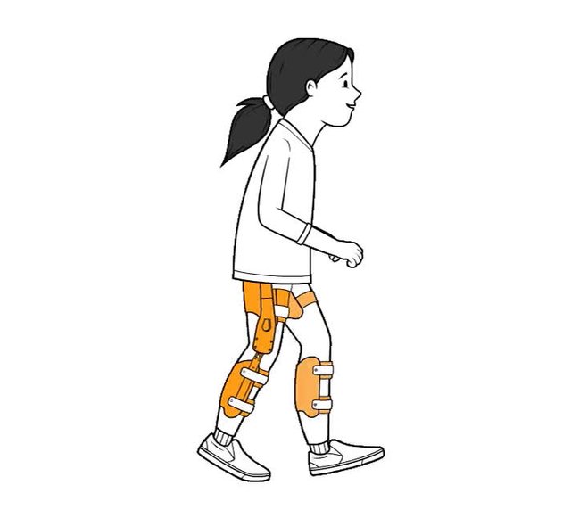 Crouch-Gait-Girl-with-device_Medium-1.mp4
