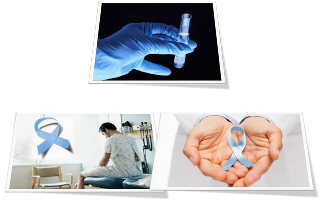 examen de sangre de prostata examen de sangre de prostata