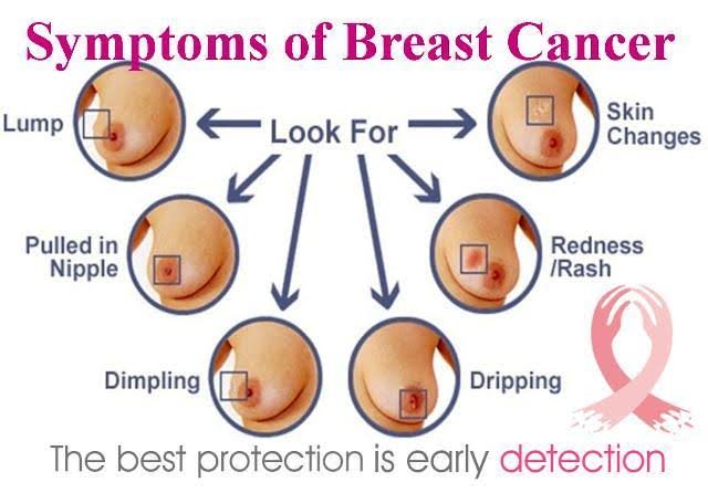 Reasons for lumps in breasts
